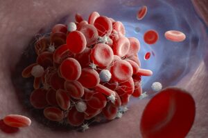 closeup of red and white blood cells experiencing MCAS