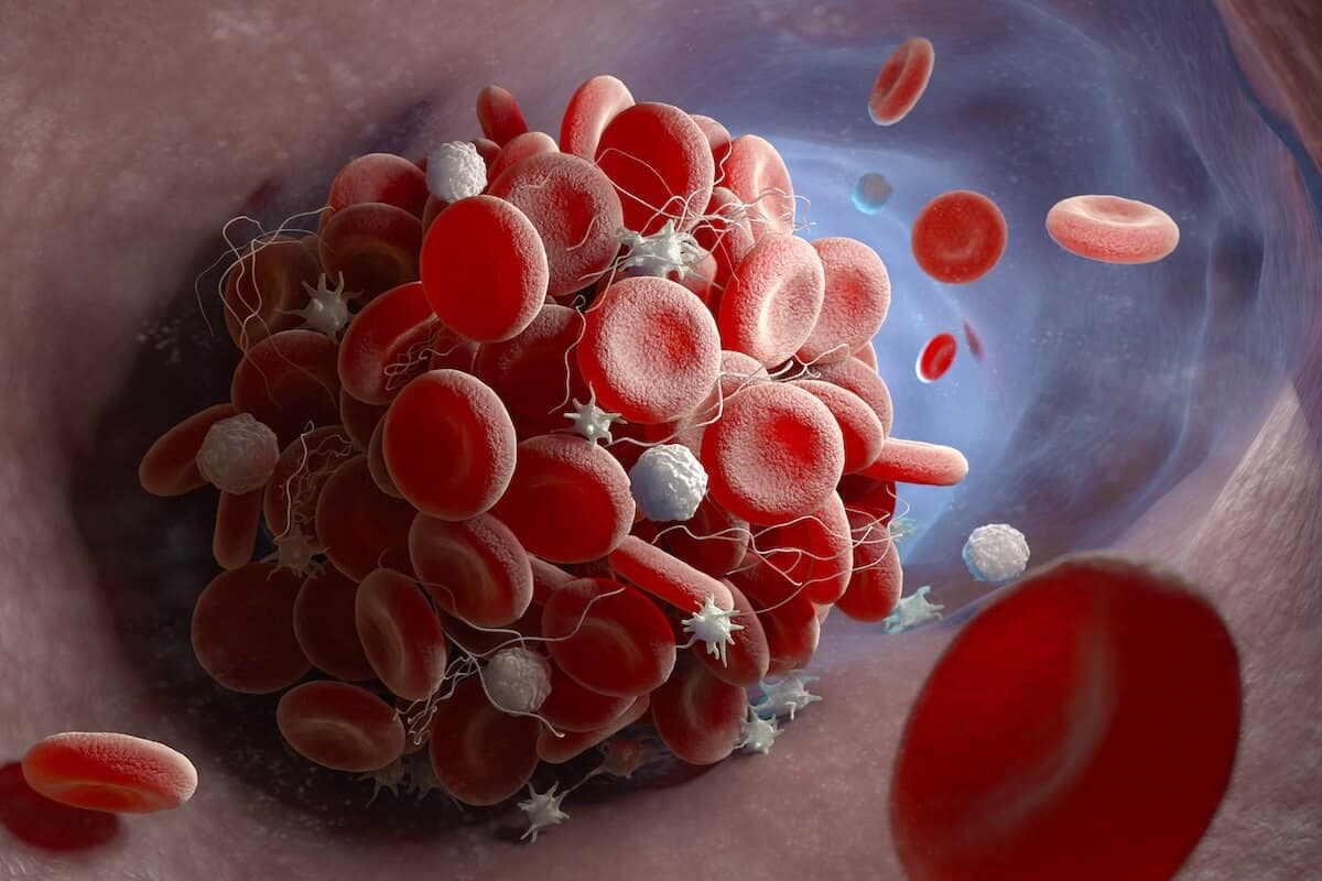 MCAS and GLP-1: What do we know