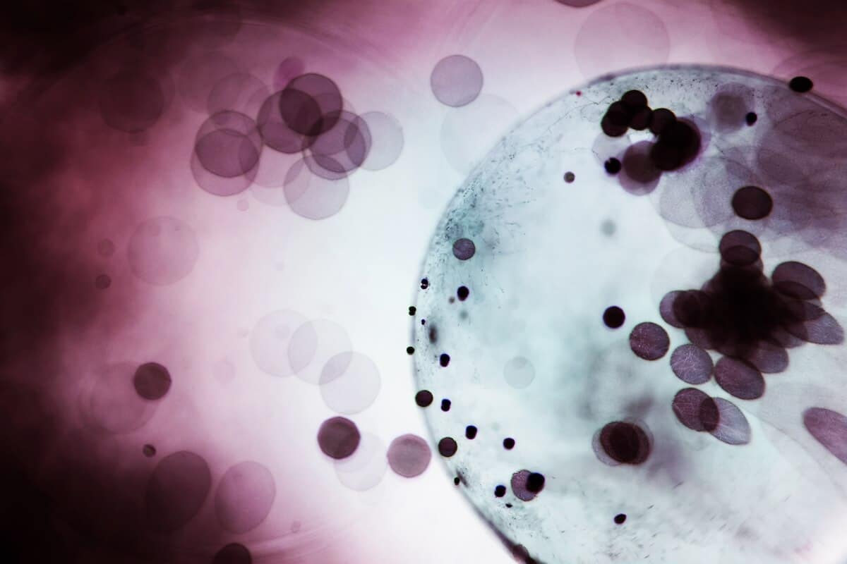 Understanding MCAS and Treatment